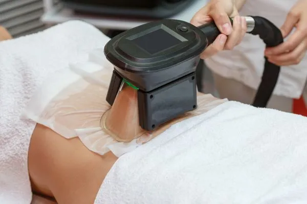 Image of person having fat freezing treatment to help weight gain Abbotsbury